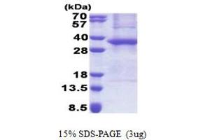 SDS-PAGE (SDS) image for Ankyrin Repeat and SOCS Box Containing 8 (ASB8) (AA 1-288) protein (His tag) (ABIN6387295)