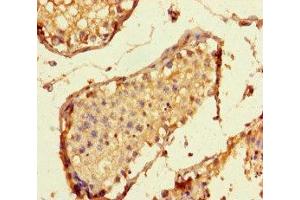 Immunohistochemistry of paraffin-embedded human testis tissue using ABIN7157667 at dilution of 1:100 (SPC24 抗体  (AA 21-97))