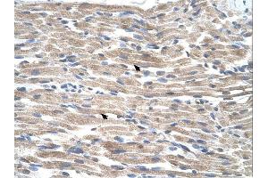 BMP2K antibody was used for immunohistochemistry at a concentration of 4-8 ug/ml. (BMP2K 抗体  (C-Term))