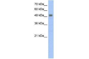WB Suggested Anti-RSAD2 Antibody Titration:  5. (RSAD2 抗体  (C-Term))