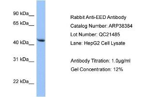 WB Suggested Anti-EED Antibody Titration: 0. (EED 抗体  (N-Term))