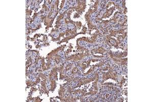IHC analysis of SAV1 using anti-SAV1 antibody (ABIN7602478).