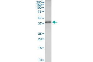 Immunoprecipitation of ANKRA2 transfected lysate using anti-ANKRA2 MaxPab rabbit polyclonal antibody and Protein A Magnetic Bead , and immunoblotted with ANKRA2 purified MaxPab mouse polyclonal antibody (B01P) . (ANKRA2 抗体  (AA 1-313))