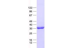 Validation with Western Blot (GATAD1 Protein (His tag))
