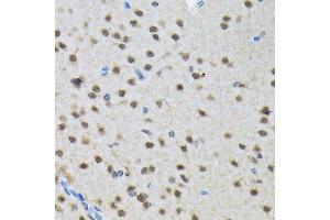 Immunohistochemistry of paraffin-embedded rat brain using SMN1 Rabbit mAb (ABIN7270651) at dilution of 1:100 (40x lens). (SMN1 抗体)