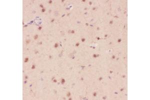 Anti-Crk p38 Picoband antibody,  IHC(P): Rat Brain Tissue (Crk 抗体  (AA 2-246))