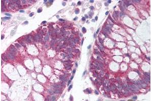 Human Colon (formalin-fixed, paraffin-embedded) stained with MKI67IP antibody ABIN214124 at 5 ug/ml followed by biotinylated goat anti-rabbit IgG secondary antibody ABIN481713, alkaline phosphatase-streptavidin and chromogen. (NIFK 抗体  (AA 140-189))