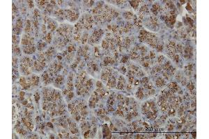 Immunoperoxidase of monoclonal antibody to ELA3A on formalin-fixed paraffin-embedded human pancreas. (Elastase 3A 抗体  (AA 16-270))