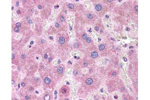 ApoB antibody was used for immunohistochemistry at a concentration of 4-8 ug/ml. (APOB 抗体  (Middle Region))