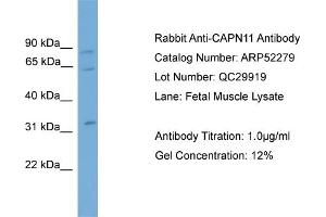 WB Suggested Anti-CAPN11  Antibody Titration: 0. (CAPN11 抗体  (N-Term))