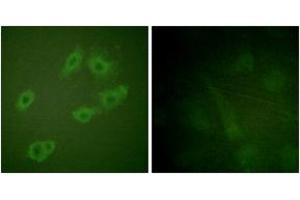 Immunofluorescence analysis of HuvEc cells, using HER3 (Phospho-Tyr1222) Antibody. (ERBB3 抗体  (pTyr1222))