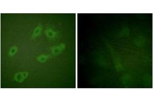 Immunofluorescence analysis of HuvEc cells, using HER3 (Phospho-Tyr1222) Antibody. (ERBB3 抗体  (pTyr1222))