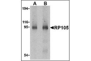 Western blot analysis of RP105 in human spleen tissue lysate with this product at (A) 0. (CD180 抗体  (C-Term))
