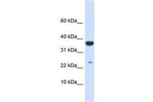 Image no. 1 for anti-Ubiquitin-Conjugating Enzyme E2D 2 (UBE2D2) (AA 36-85) antibody (ABIN6743144) (UBE2D2 抗体  (AA 36-85))