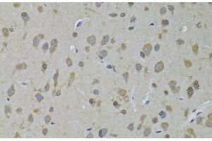 Immunohistochemistry of paraffin-embedded Rat brain using ADH5 Polyclonal Antibody at dilution of 1:100 (40x lens). (ADH5 抗体)