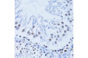 Immunohistochemistry (Paraffin-embedded Sections) (IHC (p)) image for anti-Poly (ADP-Ribose) Polymerase 1 (PARP1) (AA 81-390) antibody (ABIN6145232)