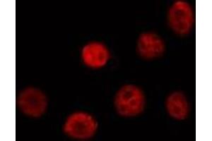anti-Dyskeratosis Congenita 1, Dyskerin (DKC1) (Internal Region) antibody