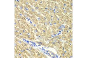 Immunohistochemistry of paraffin-embedded mouse heart using GLRX3 antibody at dilution of 1:100 (x40 lens). (GLRX3 抗体)