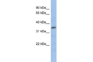 WB Suggested Anti-MYF5 Antibody   Titration: 1 ug/ml   Positive Control: Human Jurkat Cell (MYF5 抗体  (N-Term))