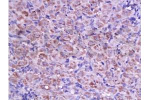 Formalin-fixed and paraffin embedded rat ovary labeled with Anti-Cyclin D2 Polyclonal Antibody, Unconjugated (ABIN738366) at 1:200 followed by conjugation to the secondary antibody and DAB staining. (Cyclin D2 抗体  (AA 161-288))