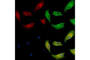 ABIN7095062 and ABIN7099118 staining  cells by IF/ICC.