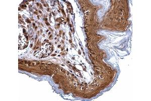 Immunohistochemistry (IHC) image for anti-Excision Repair Cross-Complementing Rodent Repair Deficiency, Complementation Group 2 (ERCC2) (Internal Region) antibody (ABIN2856090)