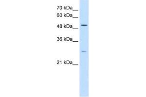 Western Blotting (WB) image for anti-Ribosomal RNA Processing 1 Homolog A (RRP1) antibody (ABIN2462903) (RRP1 抗体)