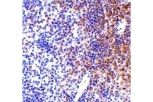 Immunohistochemistry (IHC) image for anti-Interferon Regulatory Factor 7 (IRF7) (Middle Region) antibody (ABIN1030964) (IRF7 抗体  (Middle Region))