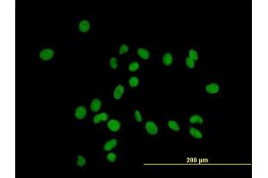 Immunofluorescence of purified MaxPab antibody to ZFP37 on HeLa cell. (ZFP37 抗体  (AA 1-630))
