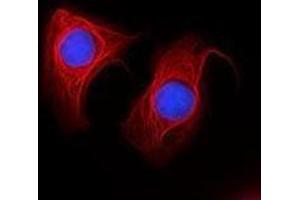 Immunofluorescence (IF) image for anti-Keratin 18 (KRT18) antibody (Alexa Fluor 647) (ABIN2657197) (Cytokeratin 18 抗体  (Alexa Fluor 647))