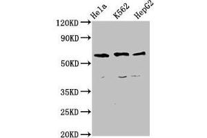 Western Blot Positive WB detected in: Hela whole cell lysate, K562 whole cell lysate, HepG2 whole cell lysate All lanes: CCT5 antibody at 4 μg/mL Secondary Goat polyclonal to rabbit IgG at 1/50000 dilution Predicted band size: 60, 50 kDa Observed band size: 60 kDa (CCT5 抗体  (AA 1-270))
