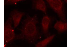 Immunofluorescence staining of methanol-fixed HeLa cells using Phospho-NF2-S518 antibody (ABIN2988202). (Merlin 抗体  (pSer518))