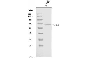 Western blot analysis of GLS2 using anti-GLS2 antibody (ABIN7599493).