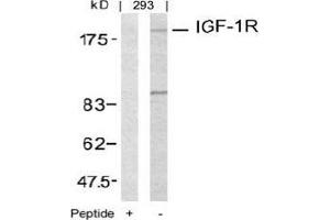 Image no. 3 for anti-Insulin-Like Growth Factor 1 Receptor (IGF1R) (Tyr1161) antibody (ABIN197242) (IGF1R 抗体  (Tyr1161))