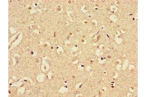 Immunohistochemistry of paraffin-embedded human brain tissue using ABIN7170721 at dilution of 1:100 (Stathmin 1 抗体  (AA 13-78))