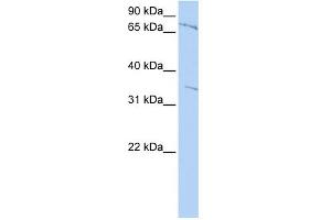 WB Suggested Anti-ZNF224 Antibody Titration:  0. (ZNF224 抗体  (Middle Region))