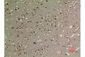 Immunohistochemistry (IHC) analysis of paraffin-embedded Human Brain, antibody was diluted at 1:100. (Tumor Protein p73 抗体  (acLys321))