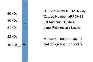 WB Suggested Anti-PSENEN  Antibody Titration: 0. (PEN2 抗体  (C-Term))