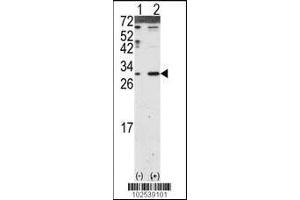 Western blot analysis of DKK2 using DKK2 Antibody using 293 cell lysates (2 ug/lane) either nontransfected (Lane 1) or transiently transfected with the DKK2 gene (Lane 2). (DKK2 抗体  (N-Term))