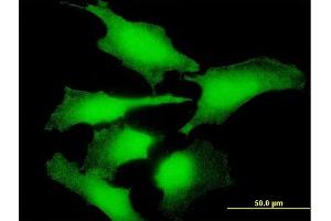 Immunofluorescence of purified MaxPab antibody to ENO1P on HeLa cell. (ENO1P1 抗体  (AA 1-388))