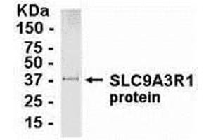 Western Blotting (WB) image for anti-Solute Carrier Family 9, Subfamily A (NHE3, Cation Proton Antiporter 3), Member 3 Regulator 1 (SLC9A3R1) (AA 240-358) antibody (ABIN2468021) (SLC9A3R1 抗体  (AA 240-358))
