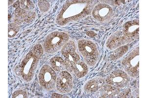 IHC-P Image MCCC2 antibody [N1C1] detects MCCC2 protein at mitochondria in mouse cervix by immunohistochemical analysis. (MCCC2 抗体  (Center))