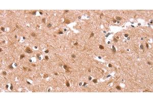 Immunohistochemistry of paraffin-embedded Human brain tissue using KCNJ6 Polyclonal Antibody at dilution 1:40 (KCNJ6 抗体)