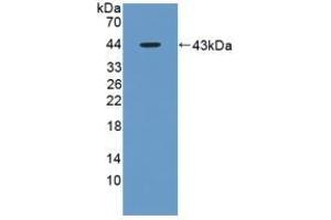 Detection of Recombinant AST, Rat using Polyclonal Antibody to Aspartate Aminotransferase (AST) (GOT1 抗体  (AA 1-413))