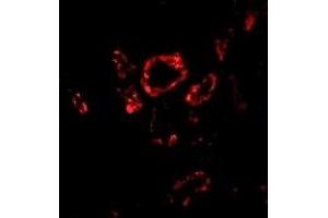 Immunofluorescence (IF) image for anti-SLUG (Middle Region 2) antibody (ABIN1031203) (SLUG 抗体  (Middle Region 2))