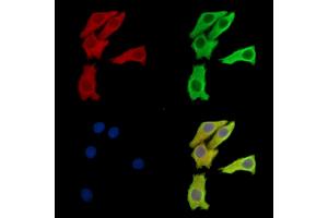 ABIN7095943 and ABIN7100005 staining Hela cells by IF/ICC. (EPM2AIP1 抗体)