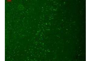 Immunofluorescence (IF) image for anti-Transient Receptor Potential Cation Channel, Subfamily M, Member 7 (TRPM7) (AA 1817-1863) antibody (ABIN361775)
