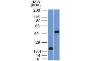 Western Blot Analysis (A) Recombinant Protein (B) Raji cell lysate Using PAX8 Mouse Monoclonal Antibody (PAX8/1492). (PAX8 抗体  (AA 60-261))