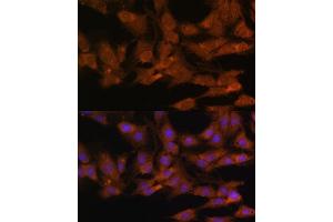Immunofluorescence (IF) image for anti-DEAD (Asp-Glu-Ala-Asp) Box Polypeptide 3, X-Linked (DDX3X) (AA 1-220) antibody (ABIN6139494)