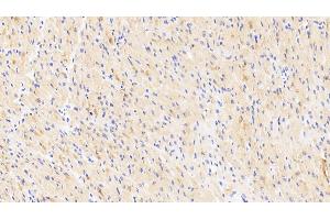 Immunohistochemistry (IHC) image for anti-Neuro-Oncological Ventral Antigen 1 (NOVA1) (AA 295-510) antibody (ABIN7444868)